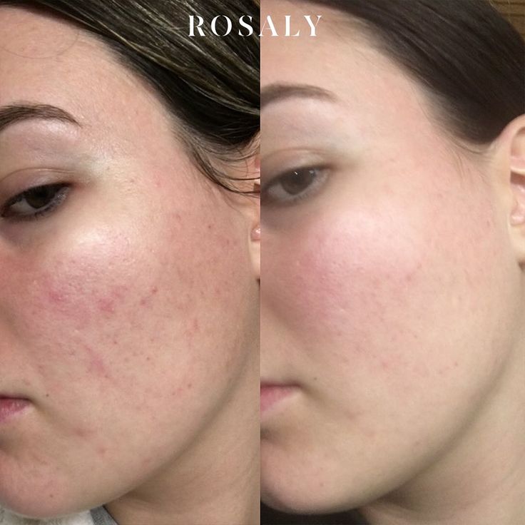 Reborn Full Body Brightening Lotion & White Beauty Skin Cream