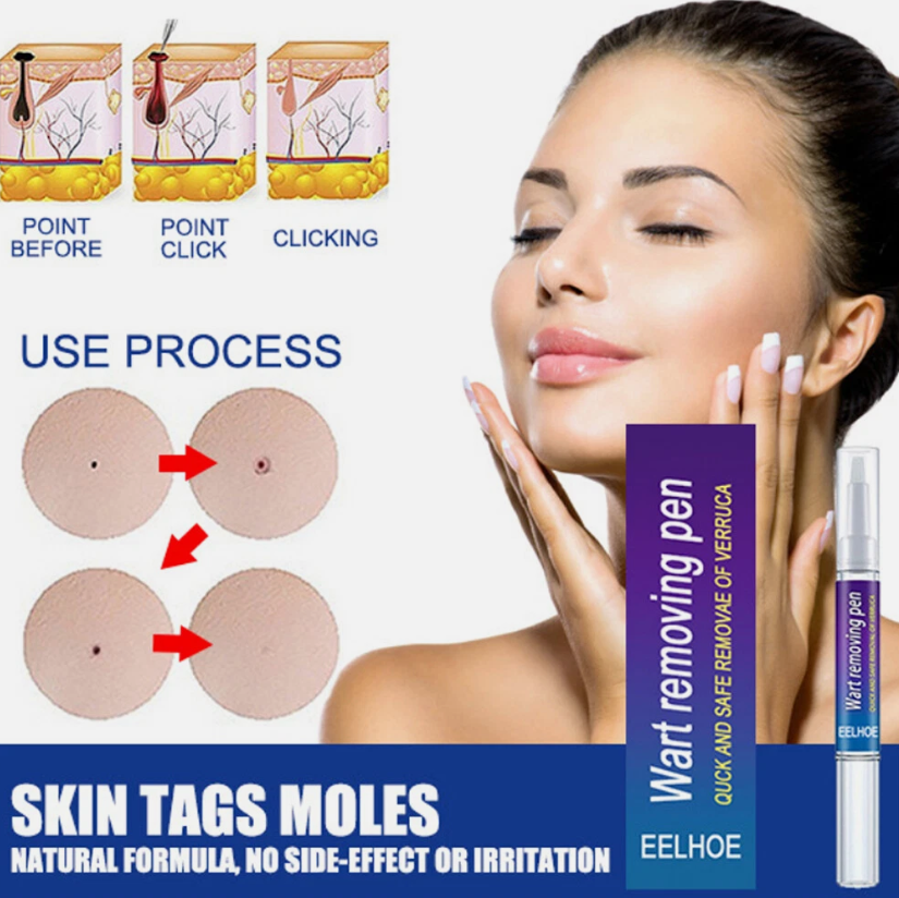 Wart Remover Skin Pen Gel - All Natural Way - Painless & Non Surgical
