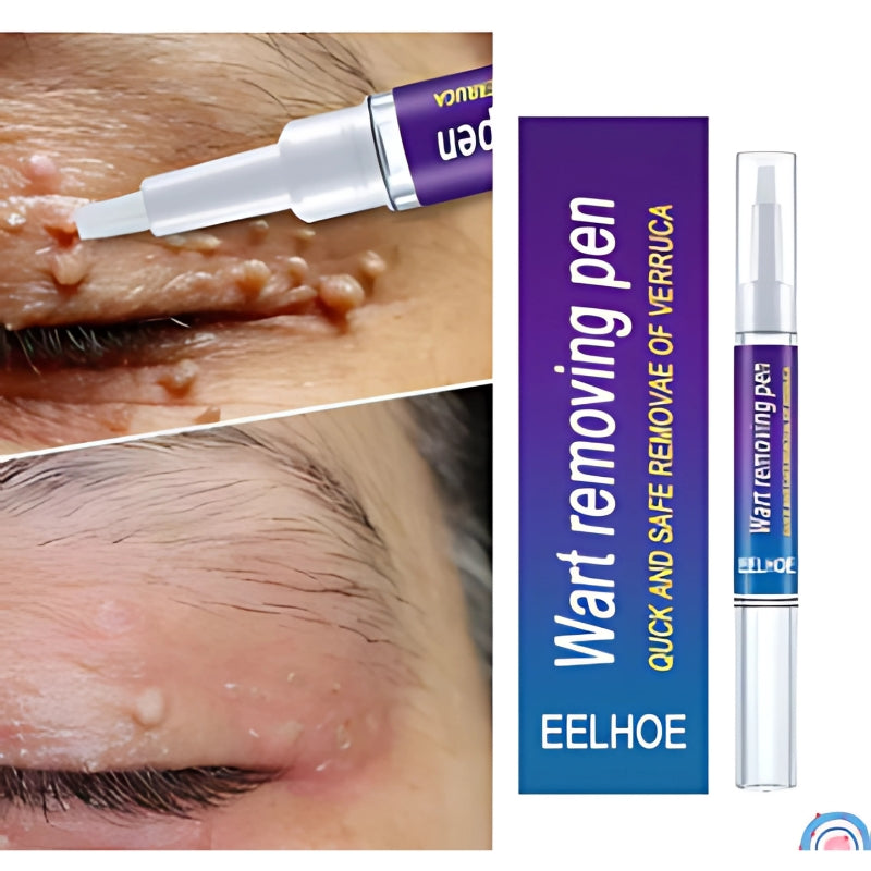 Wart Remover Skin Pen Gel - All Natural Way - Painless & Non Surgical